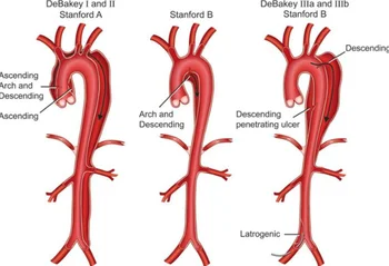 Aortas Anatomija Atloks Pin Heart/Sirds Slimības Anatomija Medicīnas Rotaslietas Dāvanu Ārsti/Medmāsas Slimnīcā Antīko Broša Vairumtirdzniecība